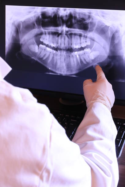 Best Dentist for Tooth Abscess  in Mesquite, TX